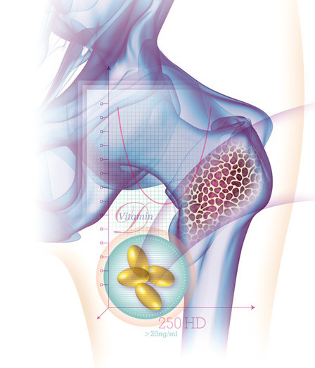 Osteoporosis, Vitamin D Illustration, Medical Illustration, Tom White, 9 Surf Studios, Directory of Illustration